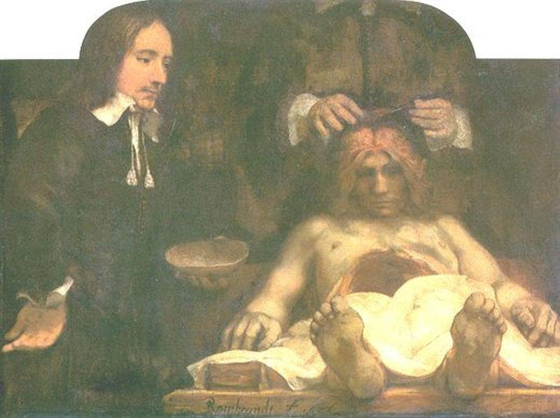 Anatomy of Doctor Deyman by Rembrandt — Oil Painting Reproduction